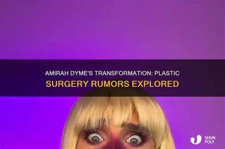 Amirah Dyme: The Transformation Before Surgery