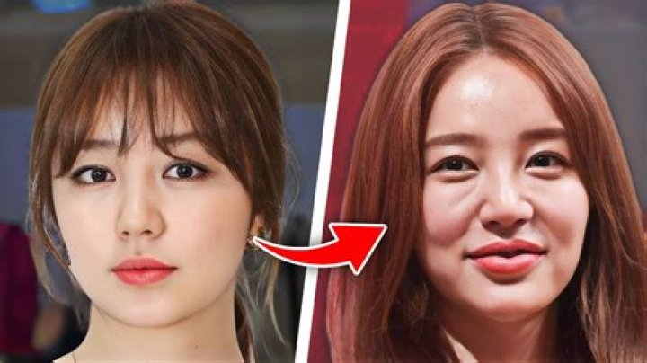 Korean Actor Plastic Surgery: Unveiling The Transformation